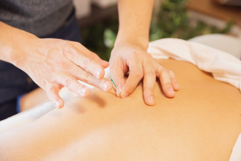 From above of crop anonymous man applying needles on back of client during acupuncture procedure